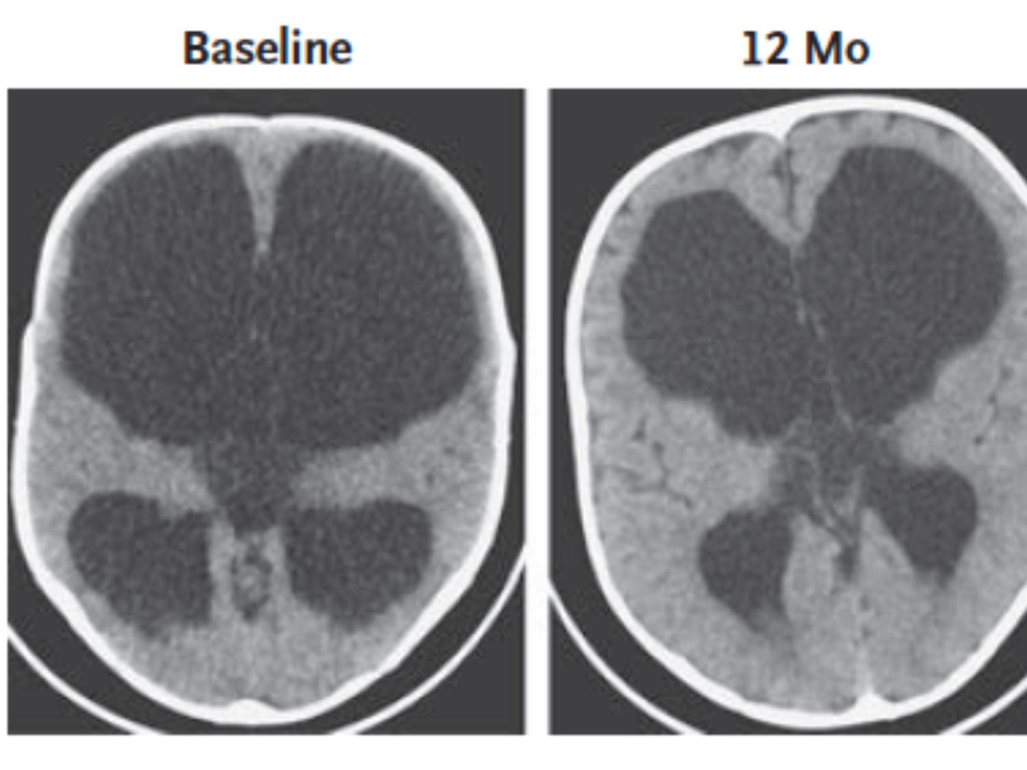 brain image