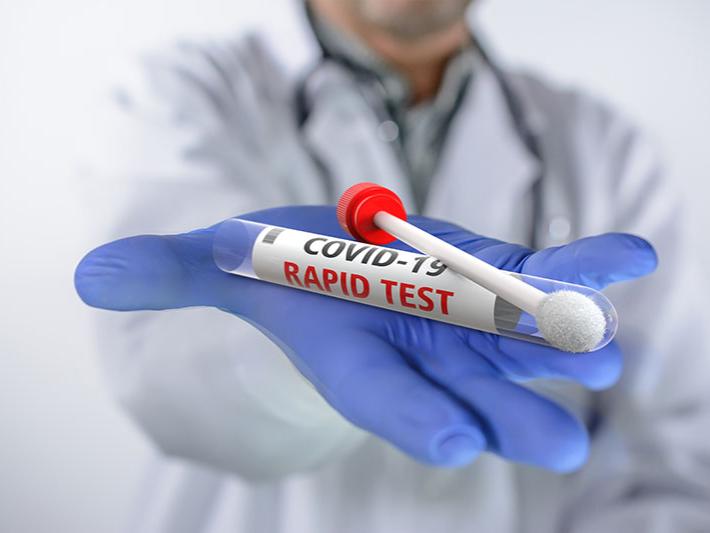 A male doctor holds a COVID-19 rapid test in his gloved hand