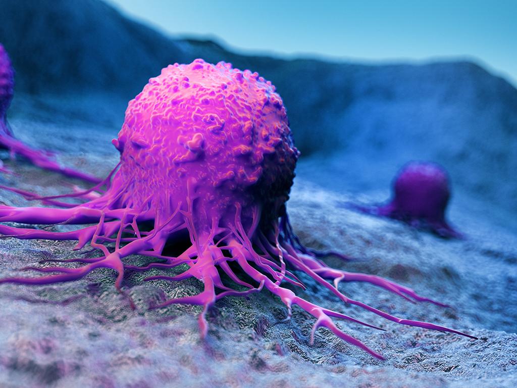 3d rendered medically accurate illustration of a cancer cell