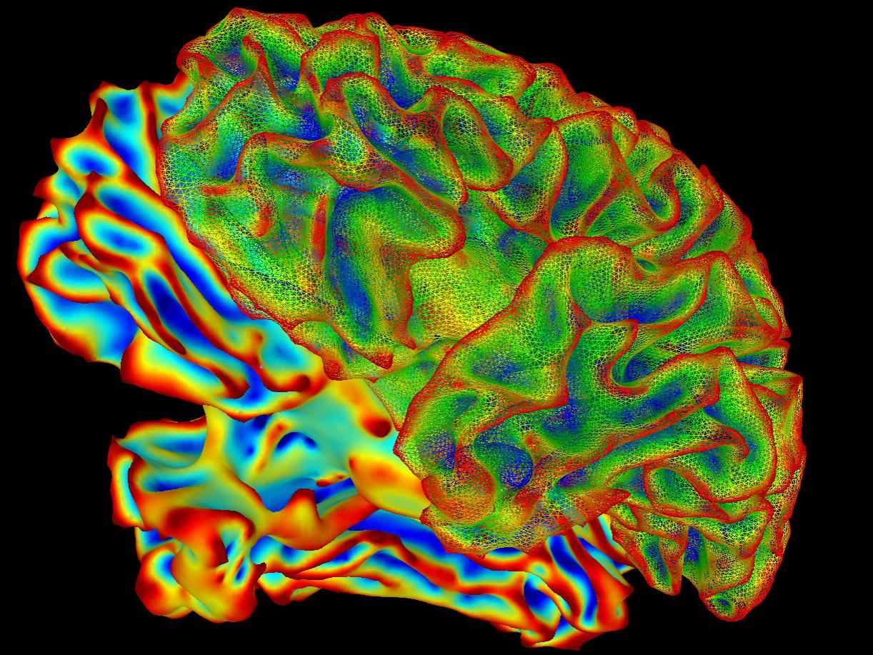 A human brain, depicted in a multi-color scan