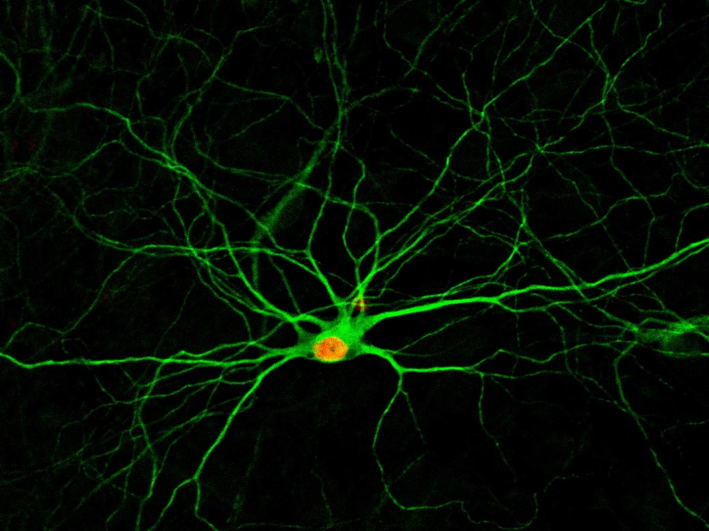 astrocyte-converted neuron