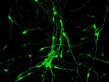 Astroglial cells after treatment