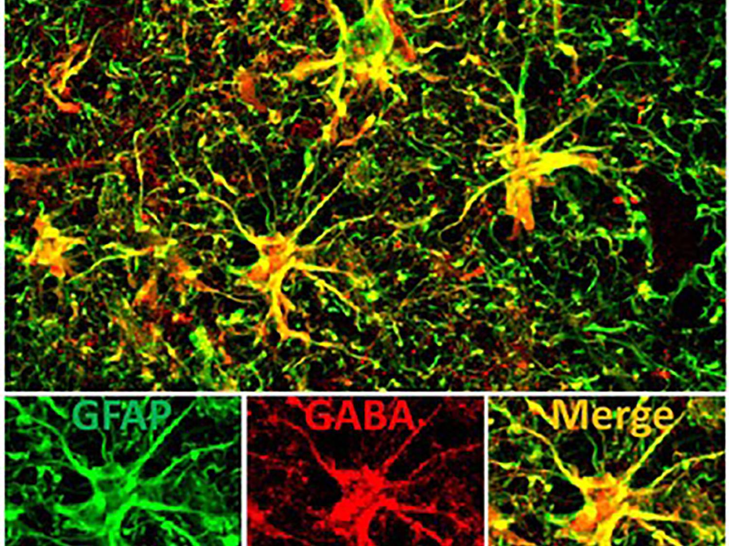 astrocytes
