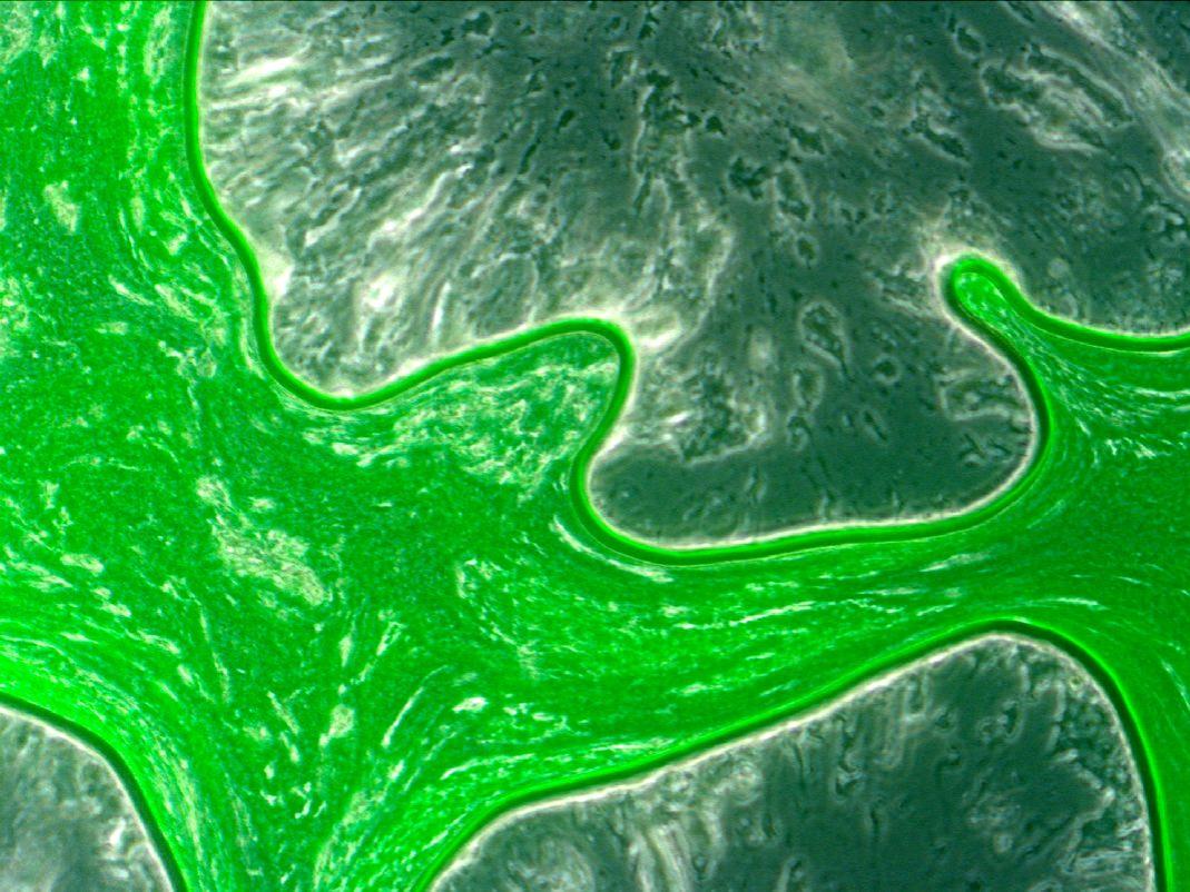 Coral pathogen