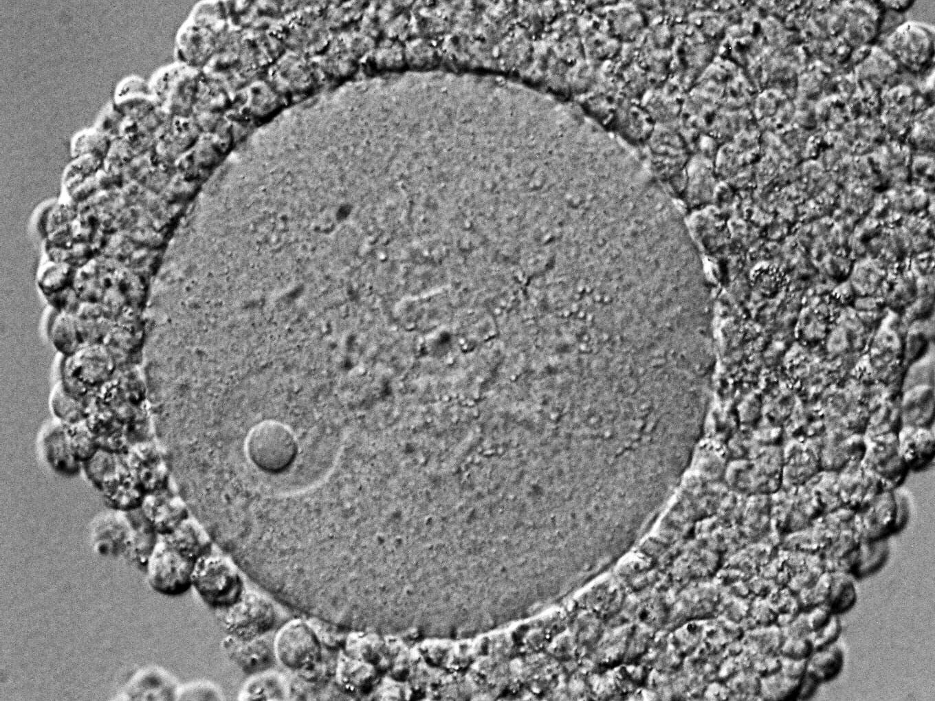 Cumulus-oocyte complex