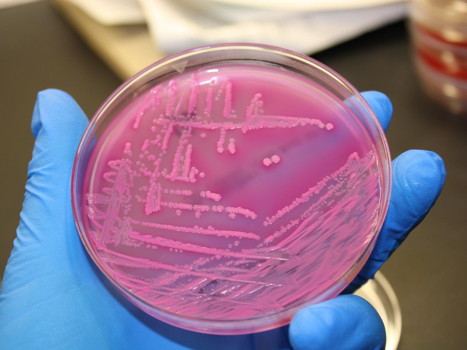 bacteria