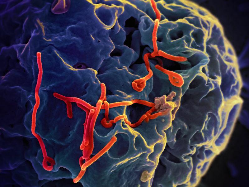 A magnified image of Ebola virus