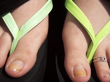 A pair of feet in flip-flops