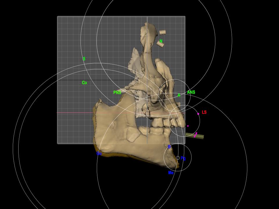 Forensic art skull illustration