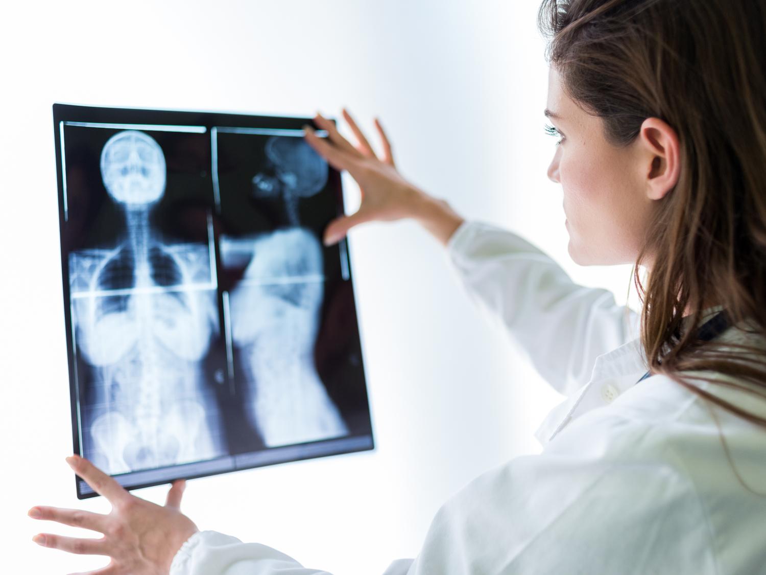 Doctor looks at X-Ray