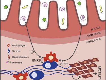 schematic of bowel