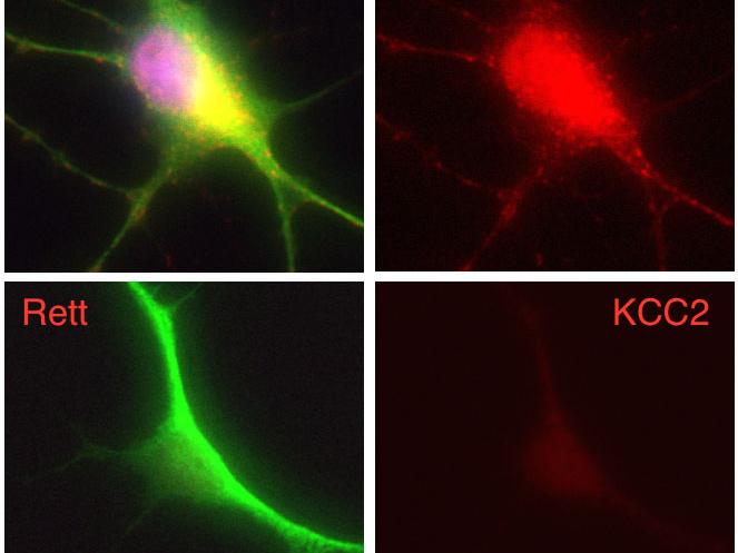 four images of a nerve cell on a black background