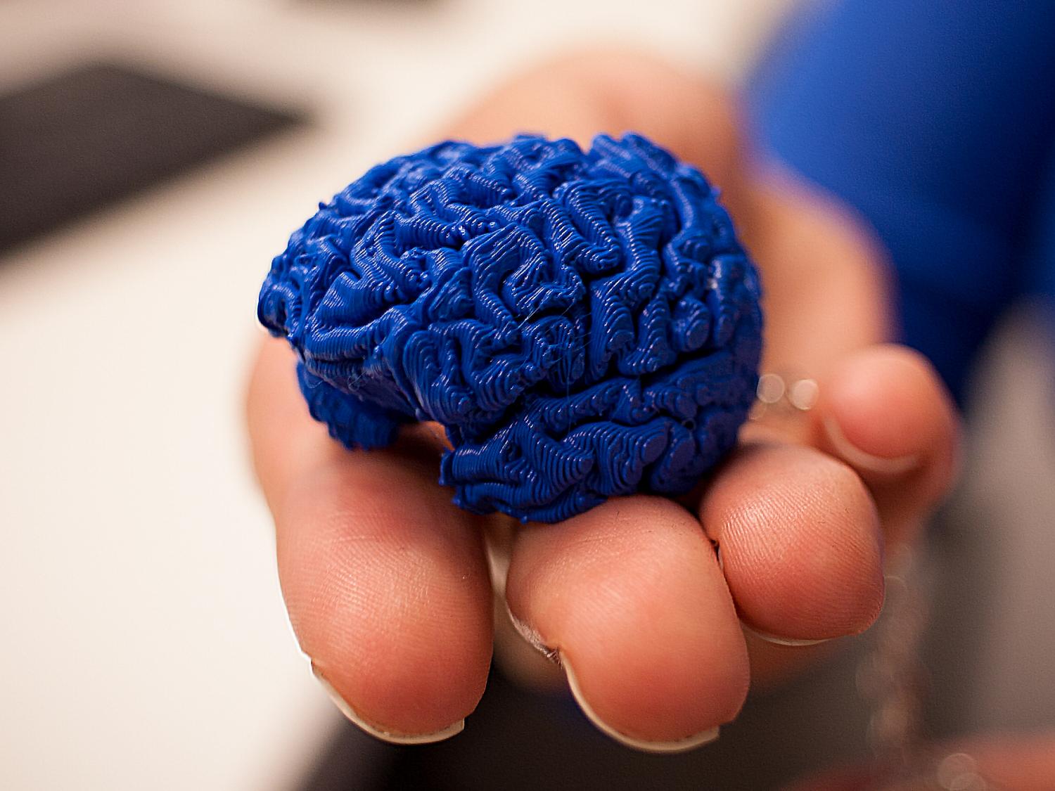 A person holds a blue, 3-D printed model of the brain. 