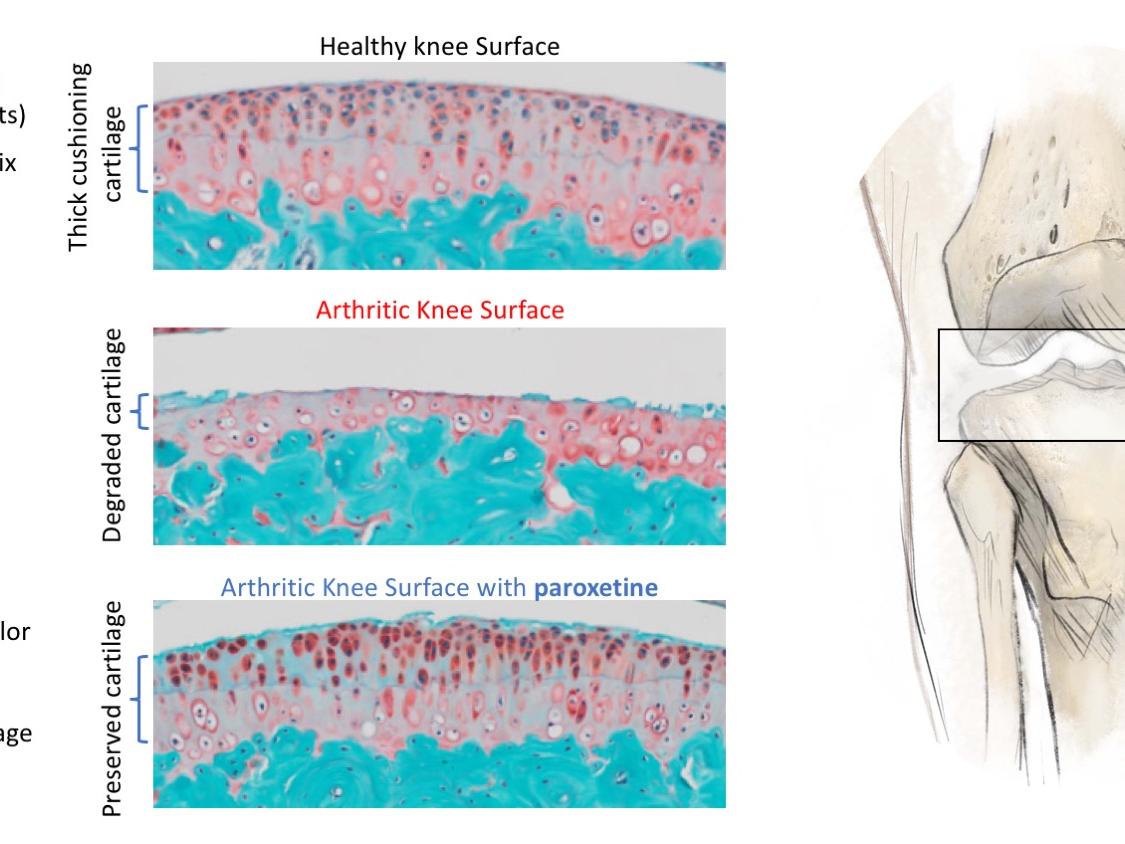 image showing cartilage regeneration