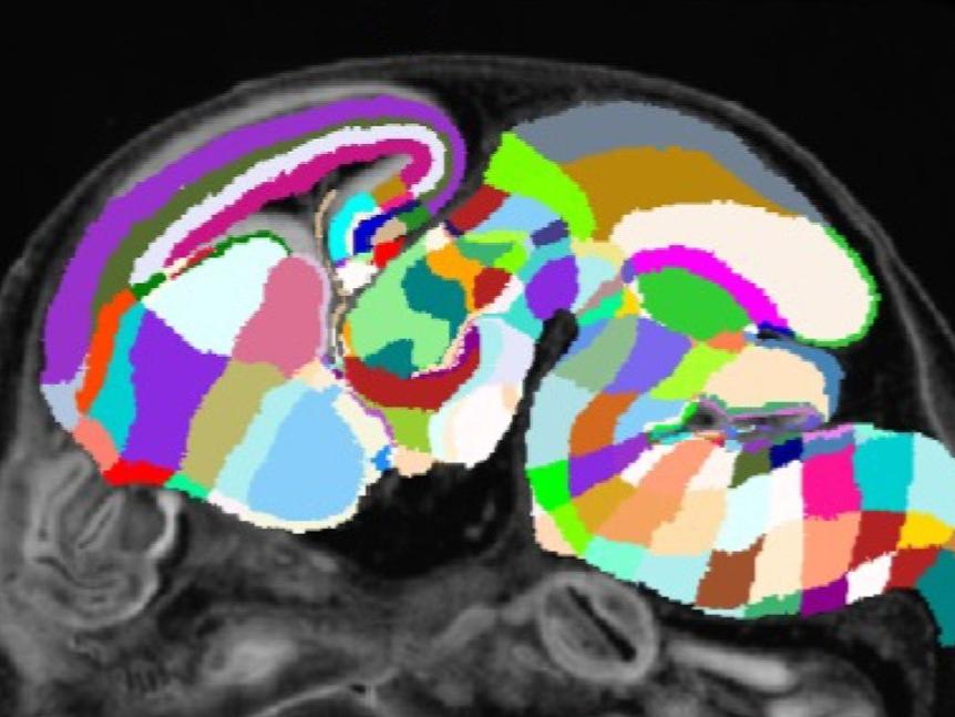An image of a mouse brain has different sections labeled using various colors. 