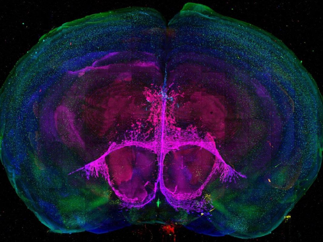 A map of cell types in a developing mouse brain 