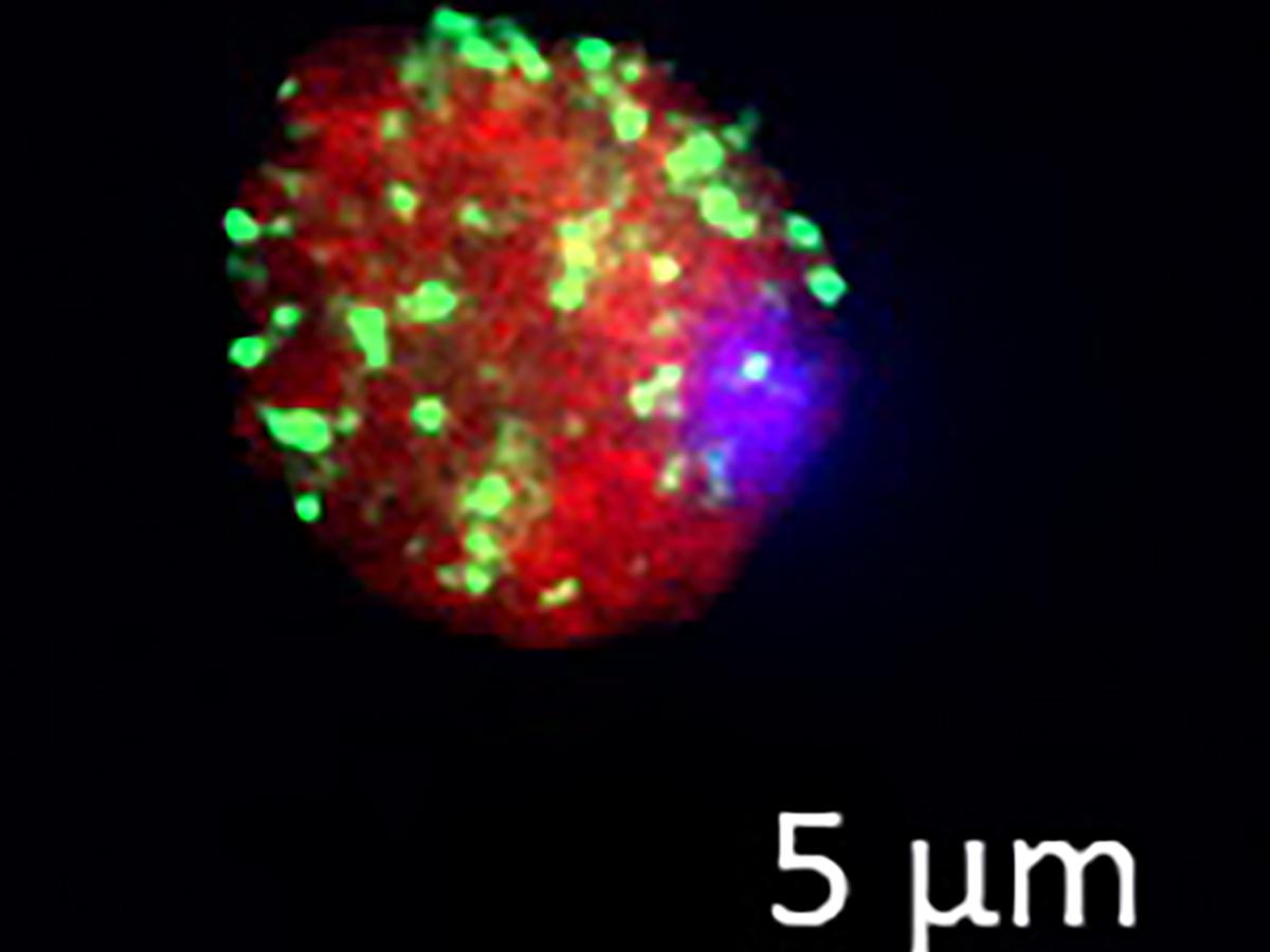Fluorescent staining of the CAF1/CCR4/NOT complex in the malaria parasite