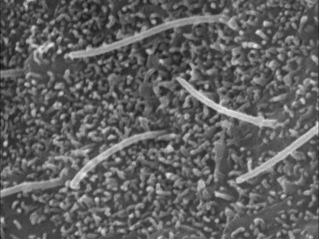 Critical Protein Discovered for Healthy Cell Growth in Mammals 