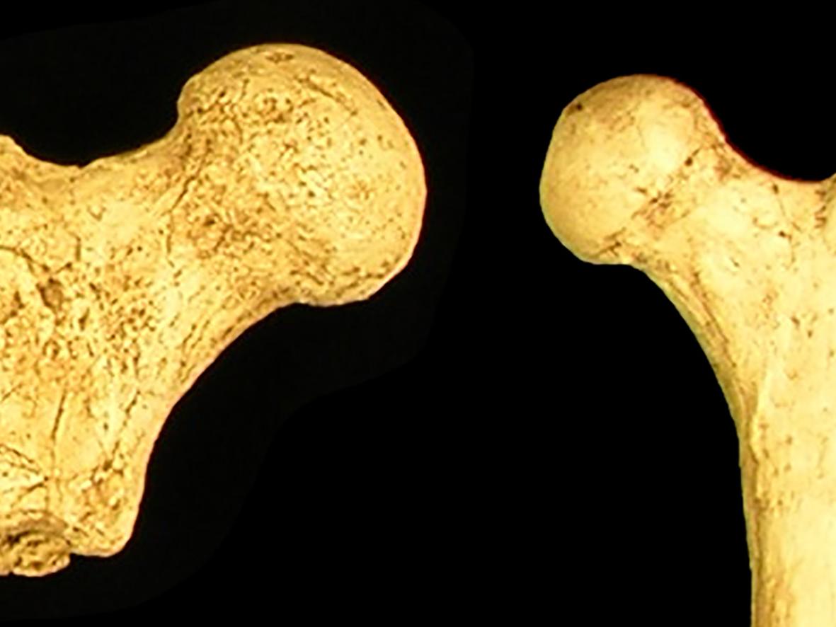 two femora bones