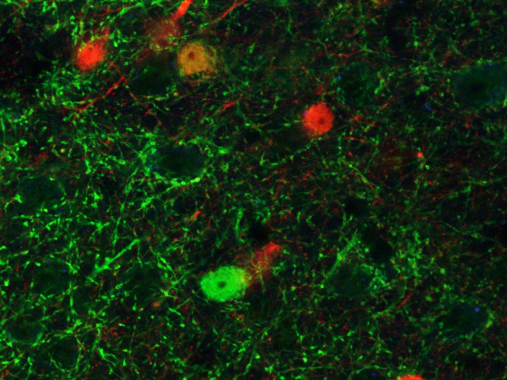 luscher brain interneurons control (L) mutant (R)