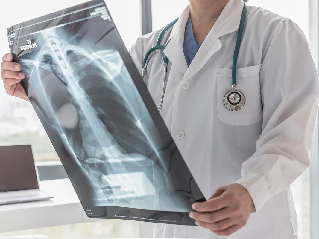 Doctor with radiological chest x-ray film for medical diagnosis on patient's health on asthma, lung disease and bone cancer illness.