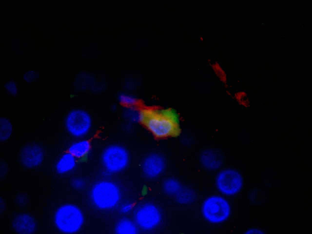 macrophage