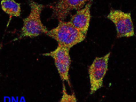 The ZNF804A protein and ribosomal protein RPSA stained with fluorescent dyes.
