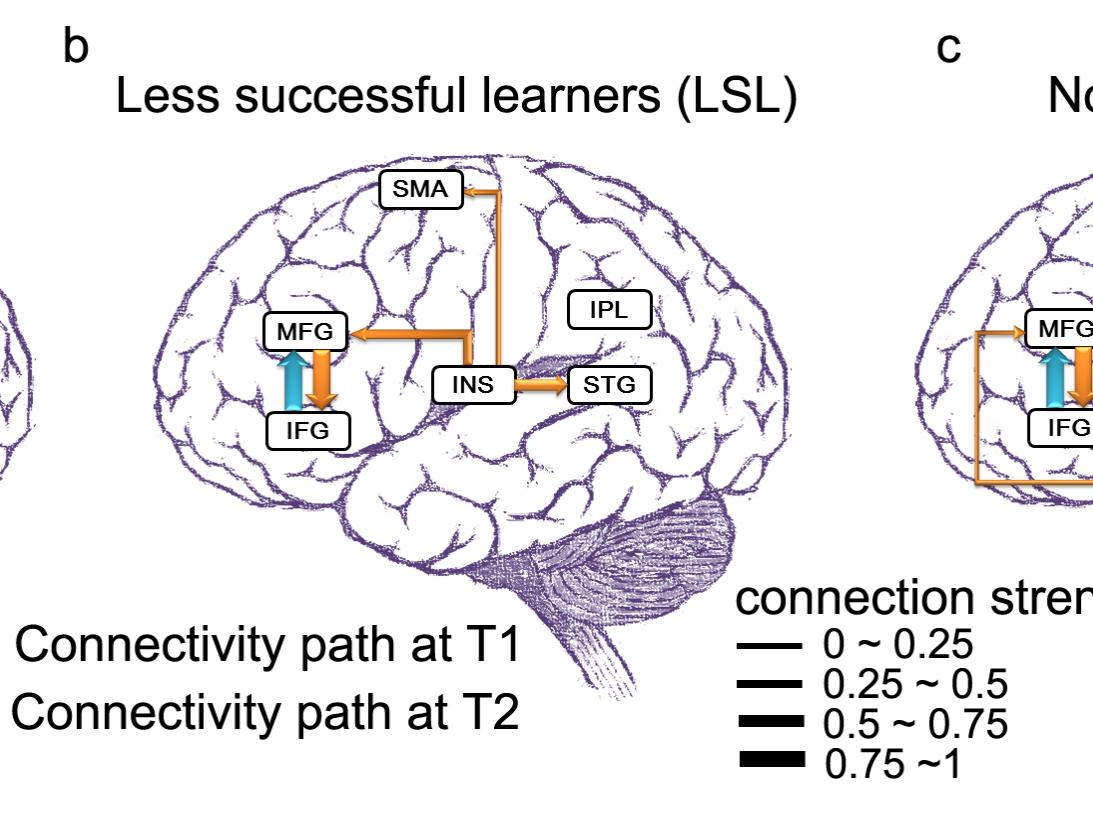 brain schematic