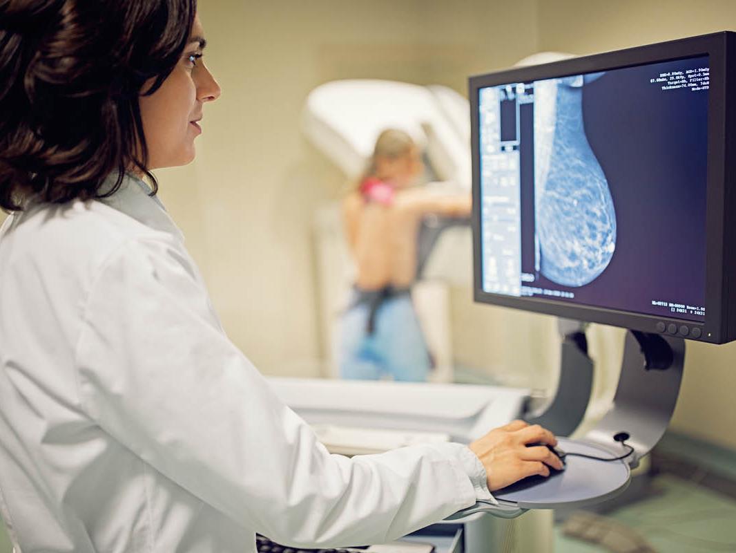 A woman in a medical coat stands at a computer. A mammogram image is on the monitor. In the background, out of focus, a woman stands facing imaging equipment.