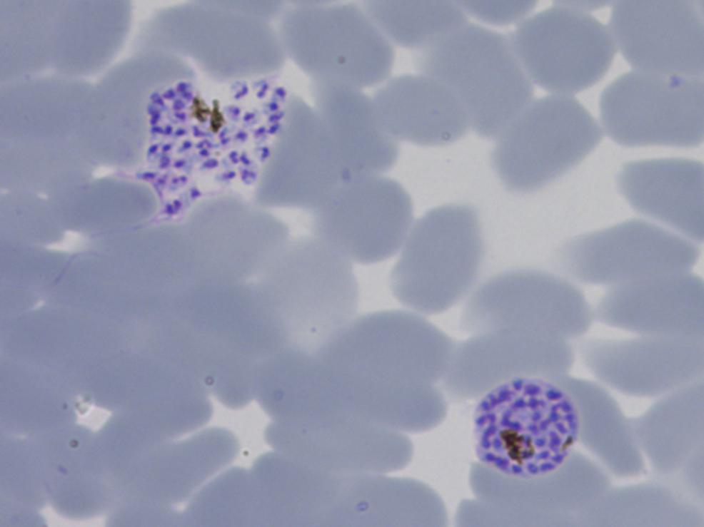 Malaria parasites in red blood cells