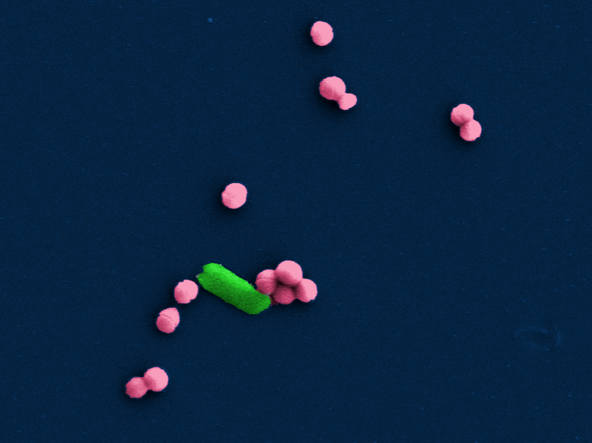 electron micrograph of bacteria