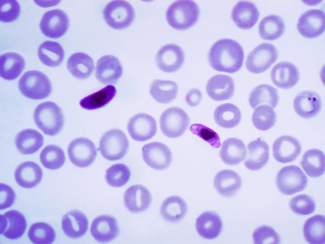 Plasmodium falciparum
