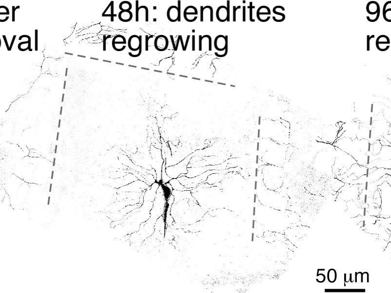 dendrite regeneration