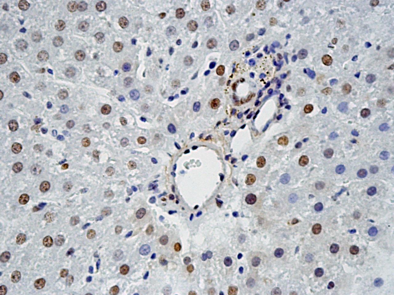 Bloomer: Aging impairs induction of redox factor-1 after heat stress