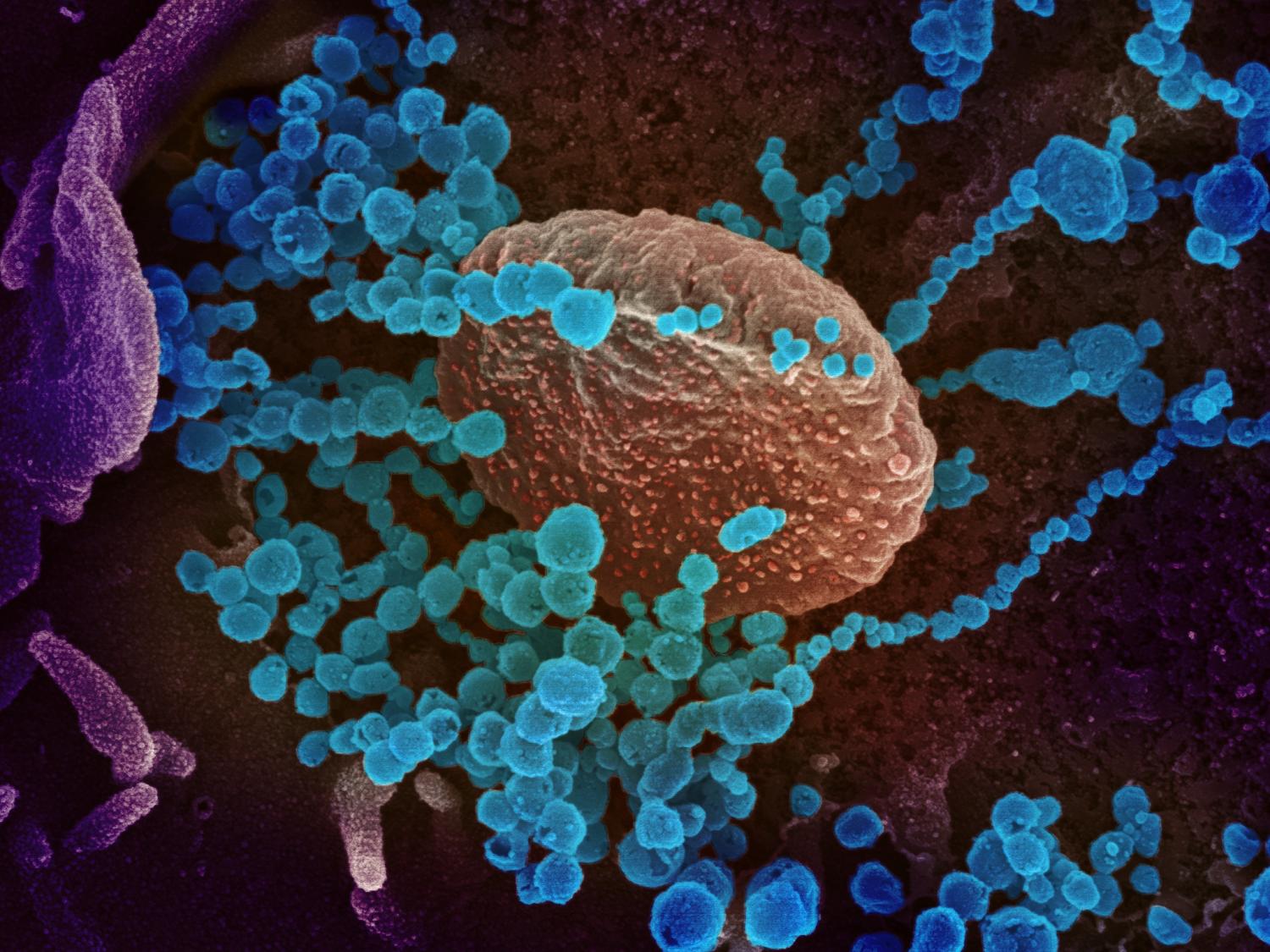 SARS-CoV-2 viruses on human cell