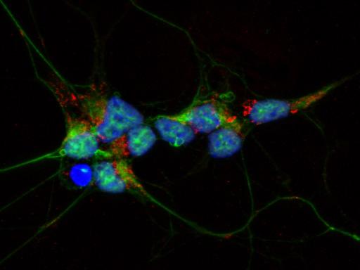 The FGAMS enzyme is expressed on human neuron-like cells