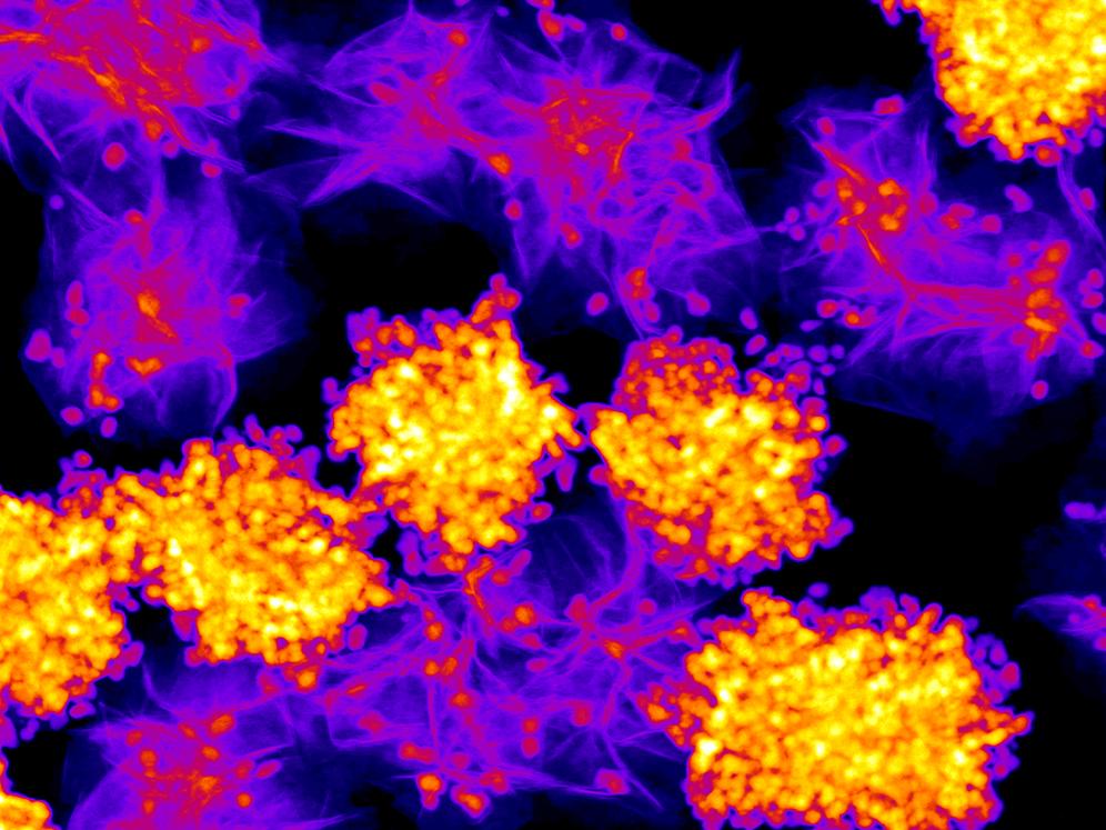 yellow and purple blobs showing  atoms