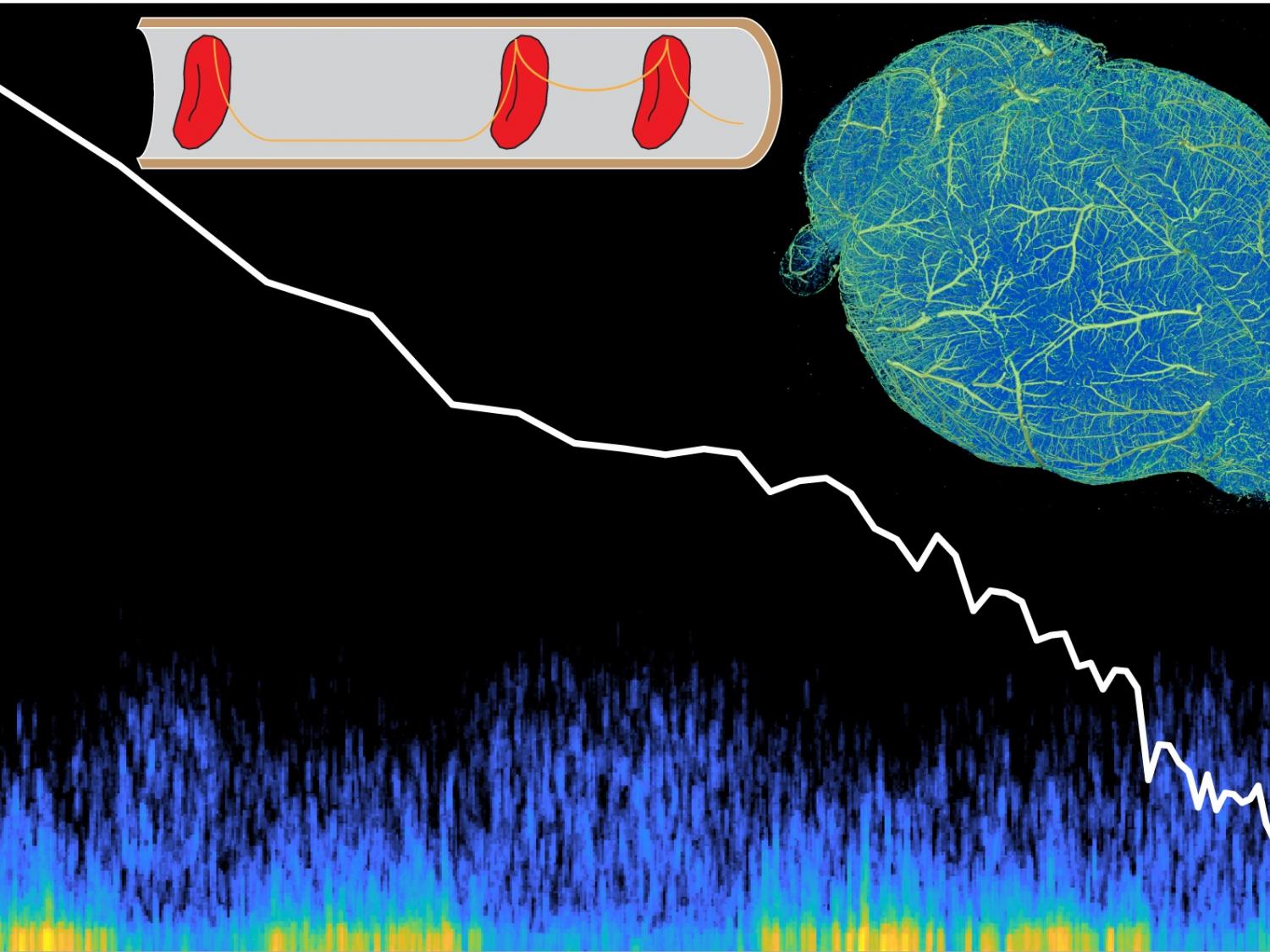A composite illustration shows a blue-and-green graph of peaks in neural activity with a white fluctuating graph line trending down superimposed above it. A red blood cell graphic (top) and mouse brain graphic (top right) are also included.