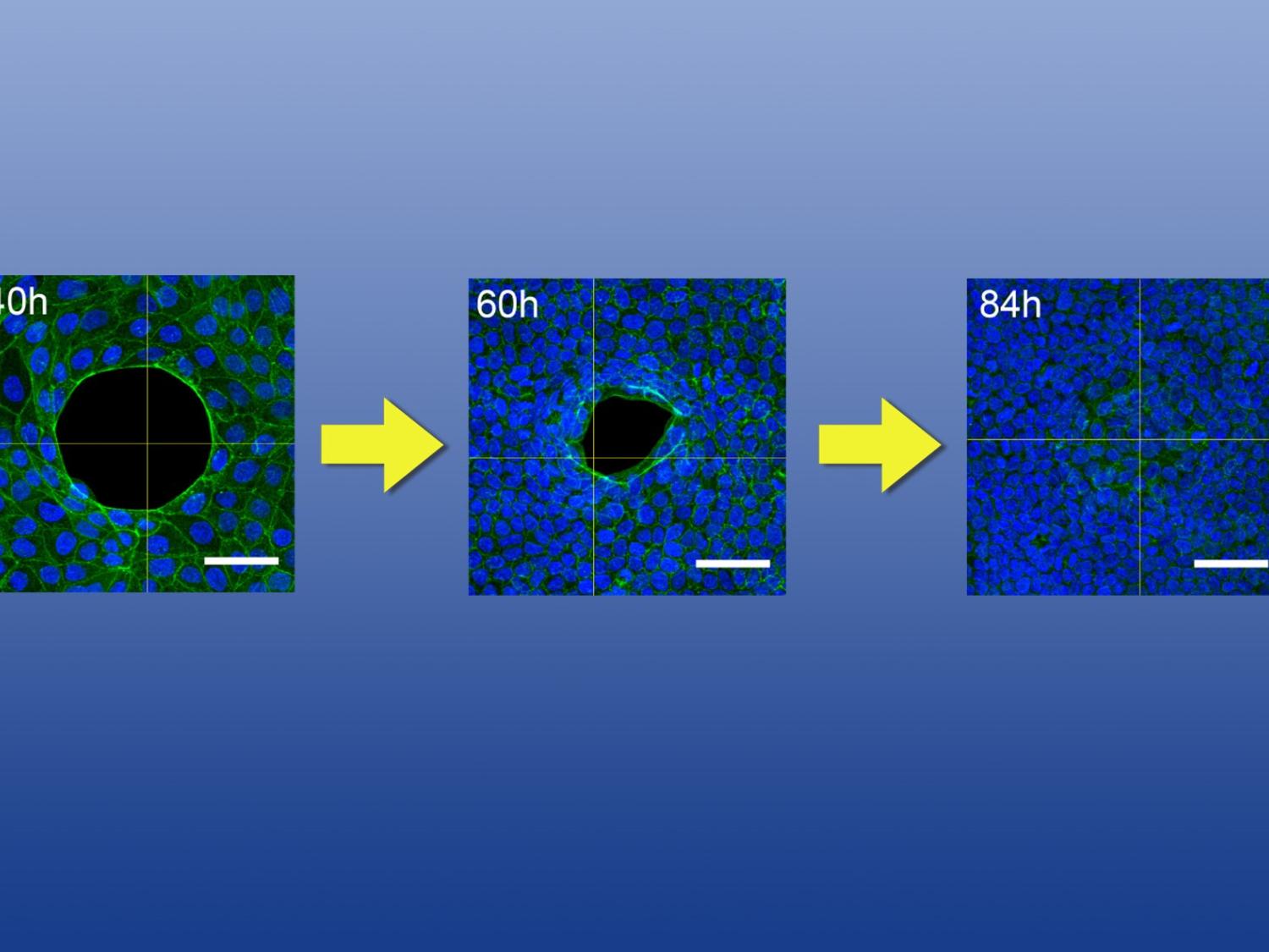 A transitional image showing gap closure of a wound