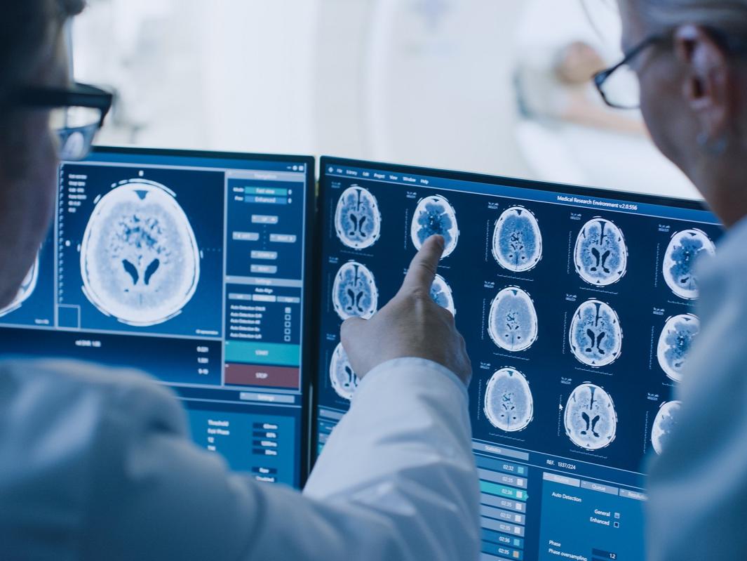 Two medical staffers in white coats look at screens containing several brain scan images. One of them points to a screen.