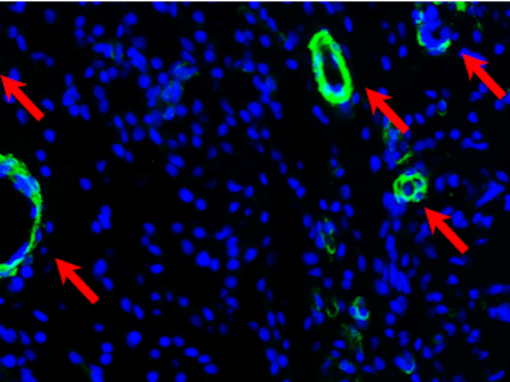 Image showing where blood vessels are growing.