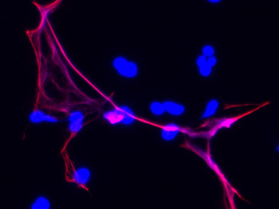 Chromatin and the PAD4 enzyme