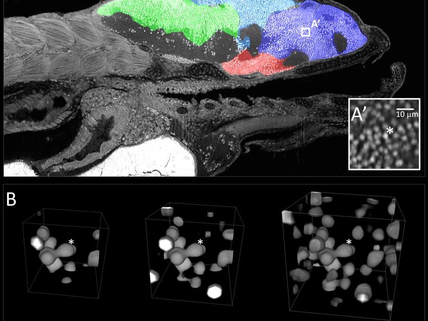 Zebrafish histology