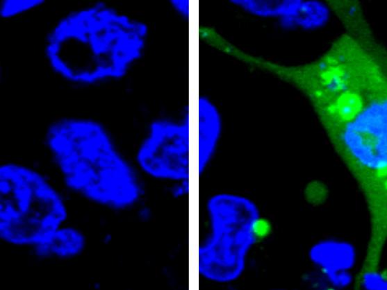 Fluorescent cells expressing a sensor before and after stress