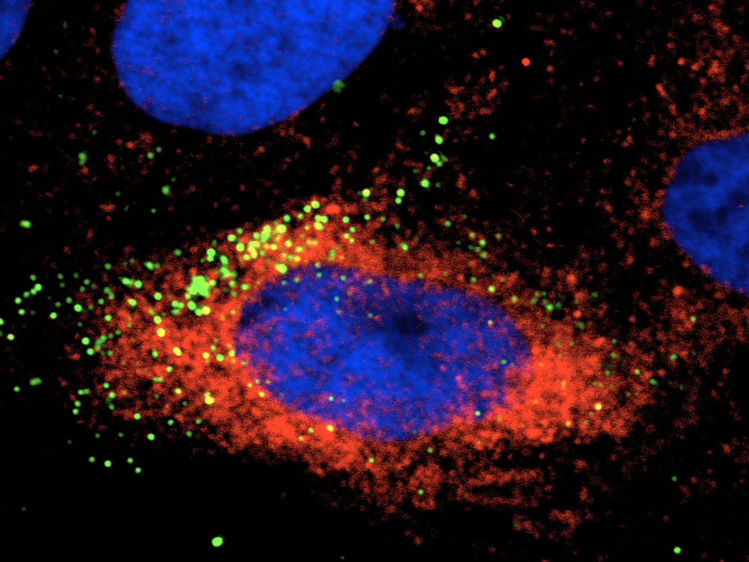 cell infected with Zika virus