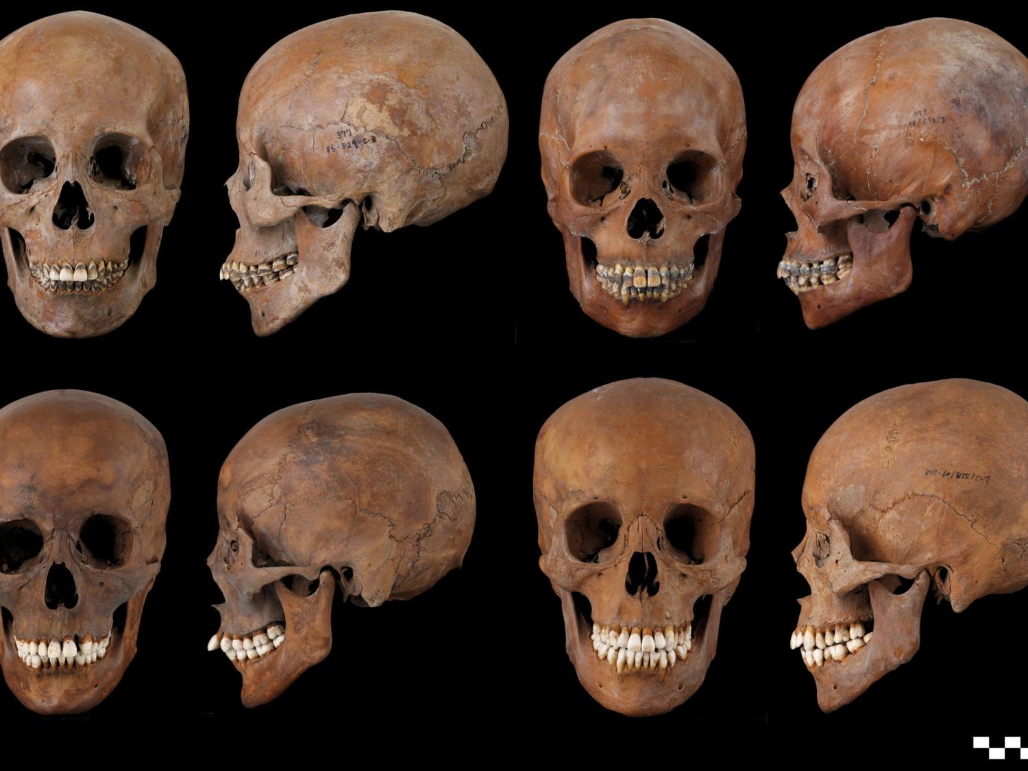 right and left images of skulls.  Pair on top have blackened teeth, pair on bottom do not