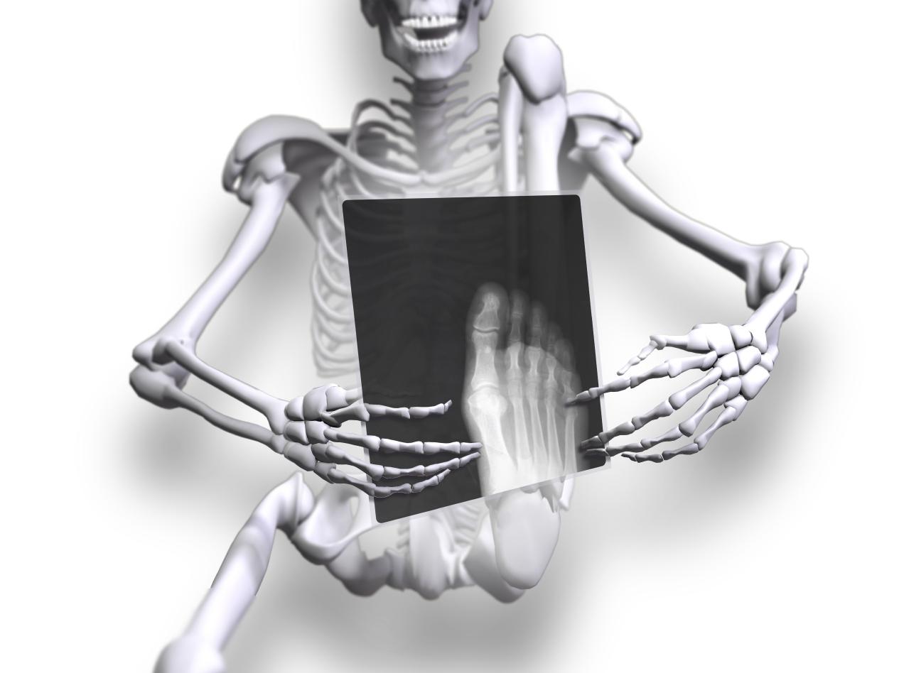 skeleton reading foot x-ray