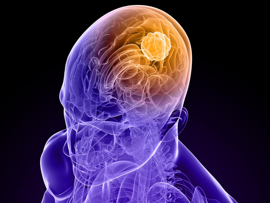 NIH grant supports study of molecular motor proteins to understand brain disease