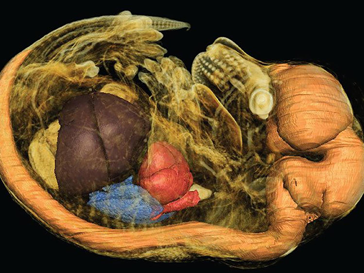 A high-resolution scan of a 3D segmented rendering of a contrast-enhanced fetal mouse—created by Penn State’s Center for Quantitative Imaging—was chosen as the cover image for the journal “Developmental Dynamics.”