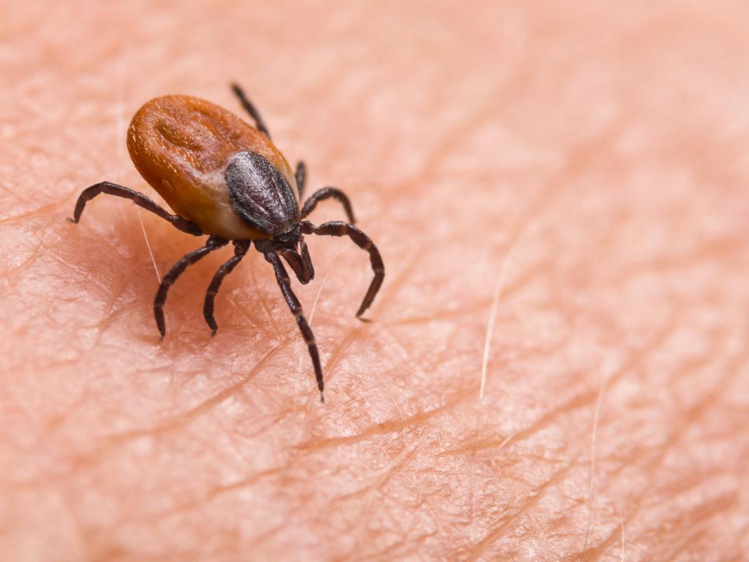 A close-up shot of a tick sitting on human skin.